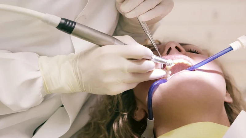What to Know Before Choosing Dental Implants